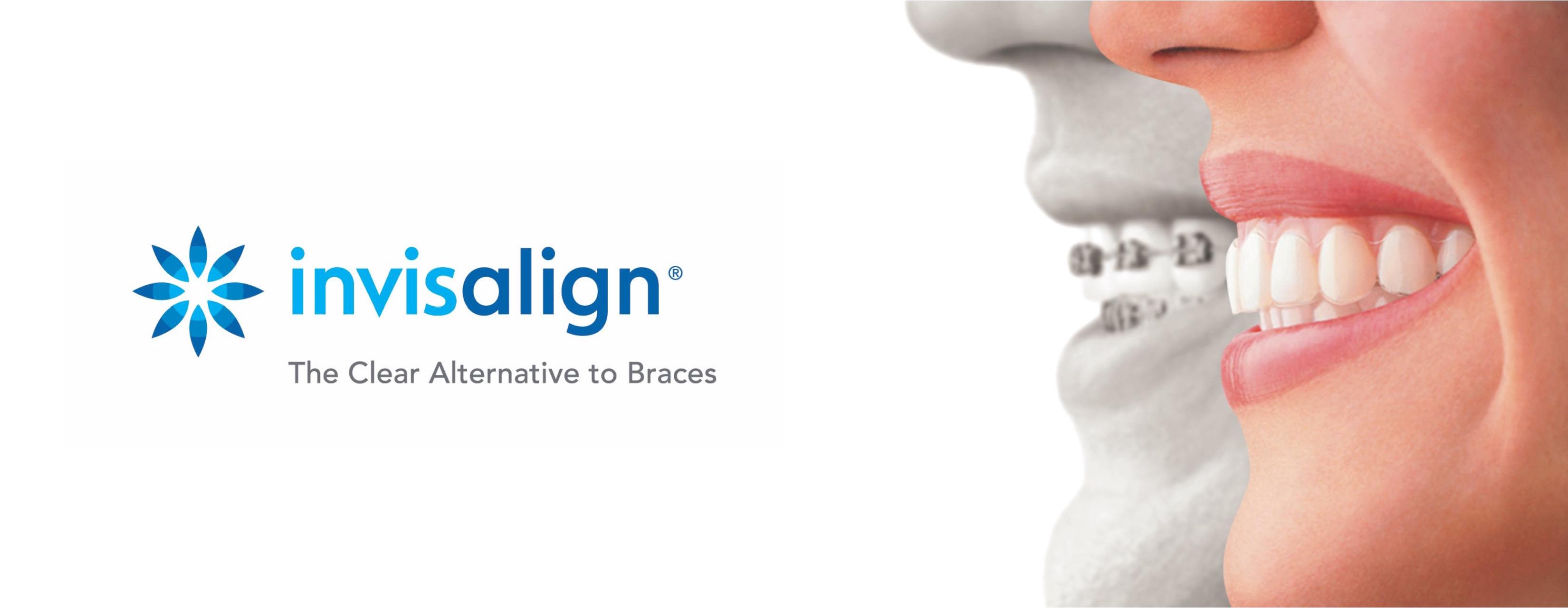 Invisalign Oakville, Invisible Braces Oakville